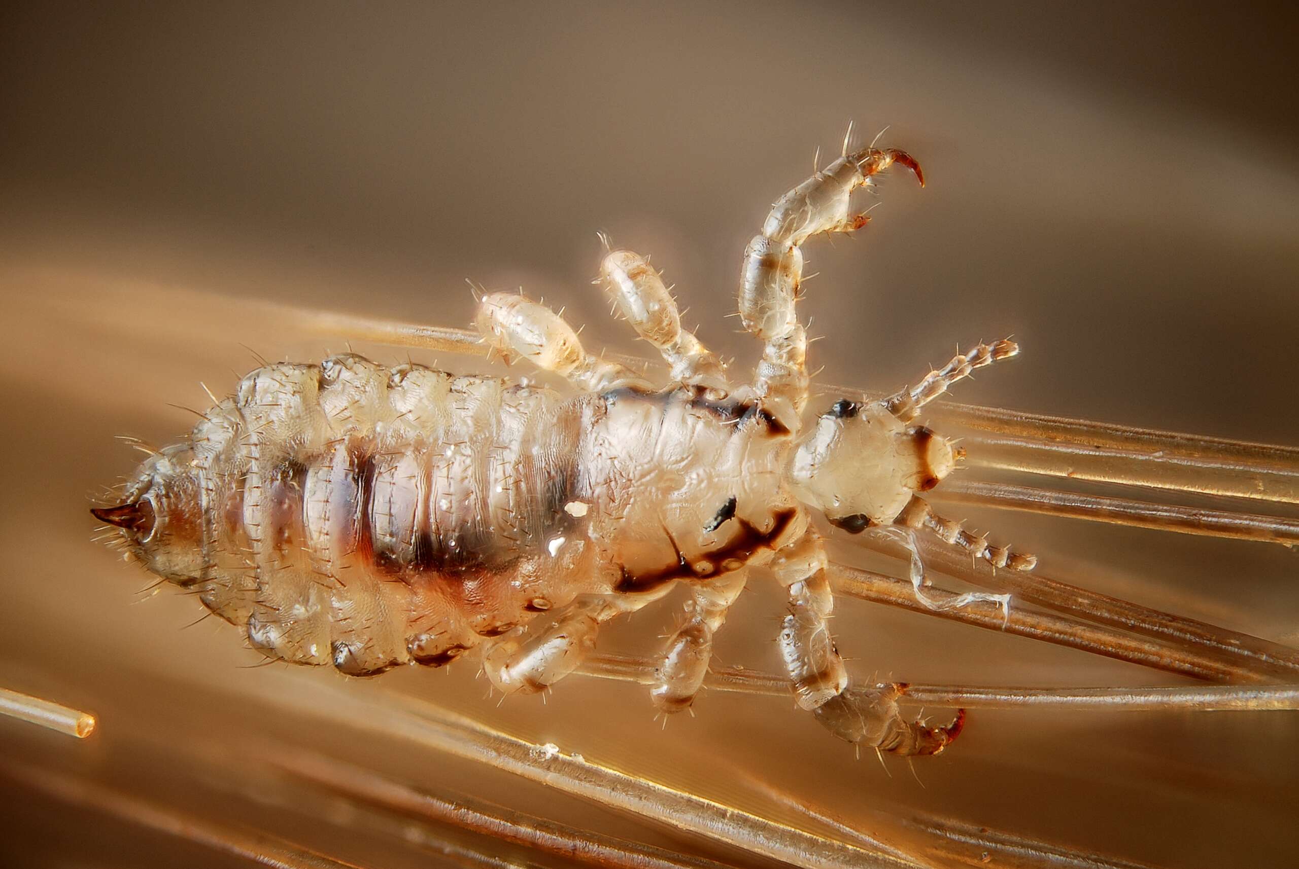 Tick Imposters: 8 Bugs That Look Like Ticks But Aren't (And Why It Matters) head lice